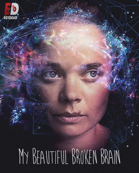 مشاهدة اونلاين فيلم My Beautiful Broken Brain 2014 مترجم